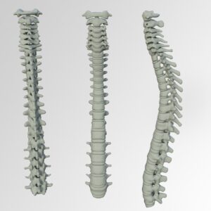spine, bone, back pain, vertebrae, band washers, disc prolapse, anatomy, human, cross, the back, backbone, spine, spine, spine, spine, spine, bone, back pain, backbone
