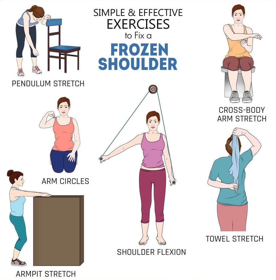 Frozen shoulder Management